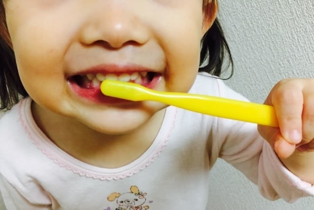 小児歯科