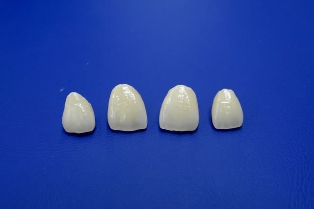 セラミック治療